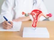 Llamado a prevenir el cáncer cervical