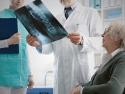 El balance y actividad física para prevenir caídas y fracturas de pacientes con osteoporosis