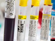 ASSMCA inicia programa para declarar zonas libres de hepatitis C