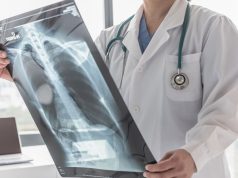 Cáncer de pulmón: una batalla que se puede ganar con detección temprana