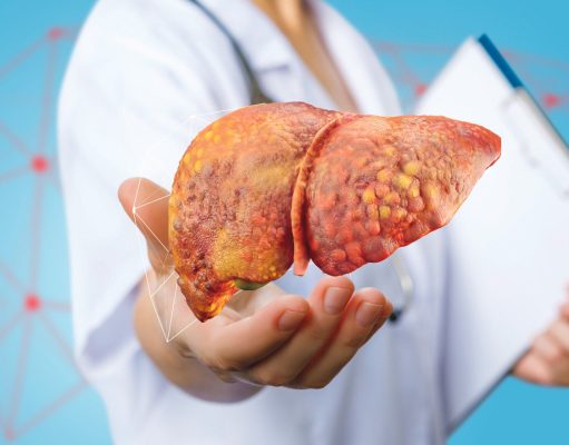 Hígado graso: Epidemia silenciosa