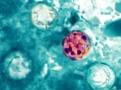 CDC investiga posible vínculo entre brote de ciclosporiasis y restaurantes Taco Bell