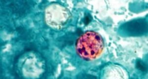 CDC investiga posible vínculo entre brote de ciclosporiasis y restaurantes Taco Bell