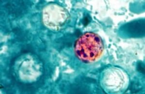 CDC investiga posible vínculo entre brote de ciclosporiasis y restaurantes Taco Bell