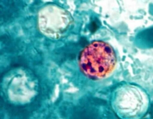 CDC investiga posible vínculo entre brote de ciclosporiasis y restaurantes Taco Bell