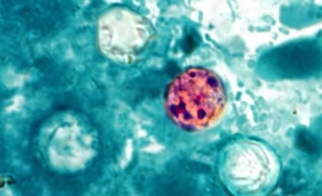cyclosporiasis parasito
